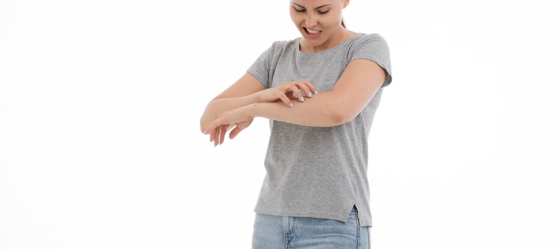 Morgellonova bolezen - srbenje